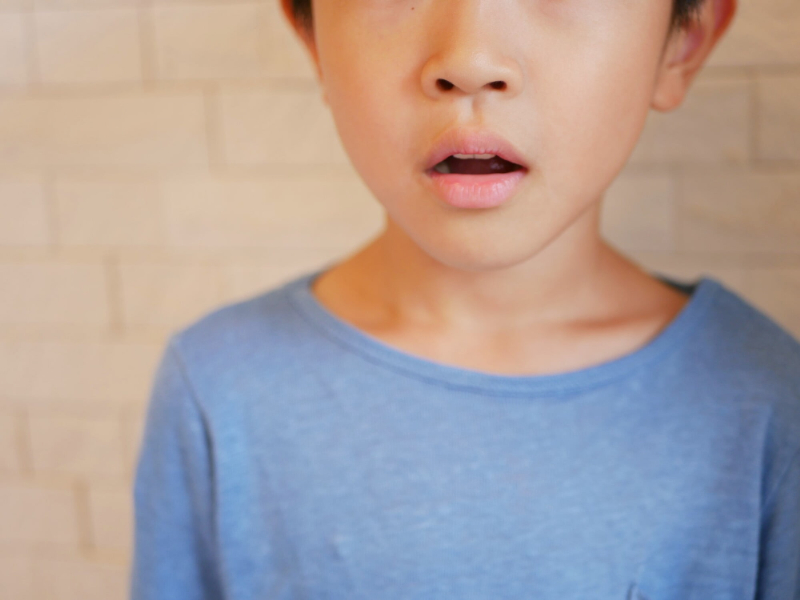 口呼吸をしているためにいつも口が開いている子ども