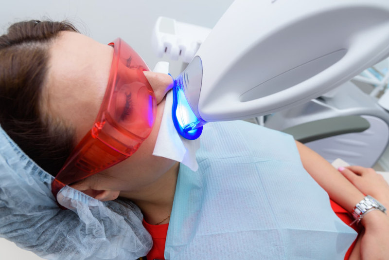 オフィスホワイトニングを施術中の患者